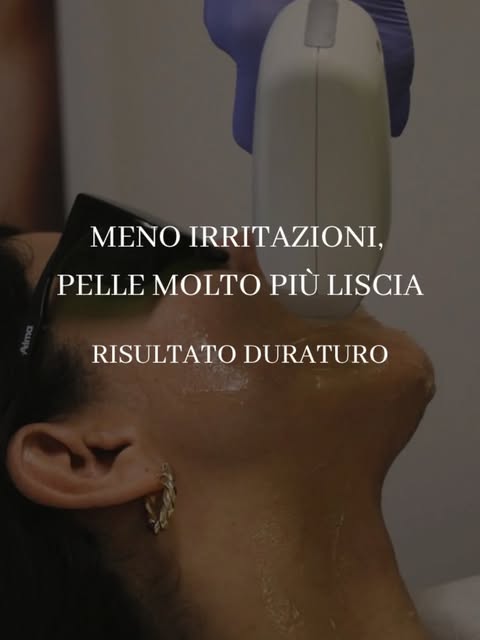 Trattamento di epilazione laser al viso
